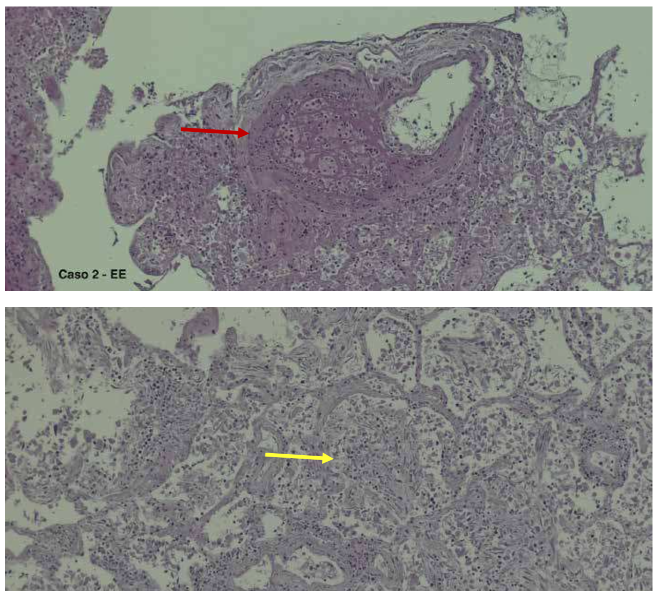 fig 1 - 2 